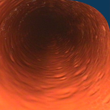 Tube Lining (5)