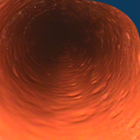 Tube Lining (7)
